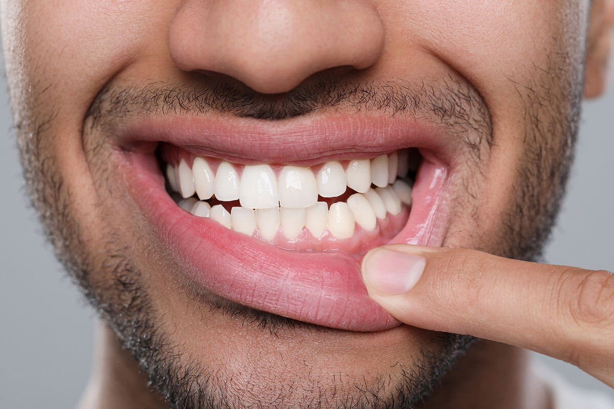 results of dental care from Beacon Hill Dental in Crown Point, IN