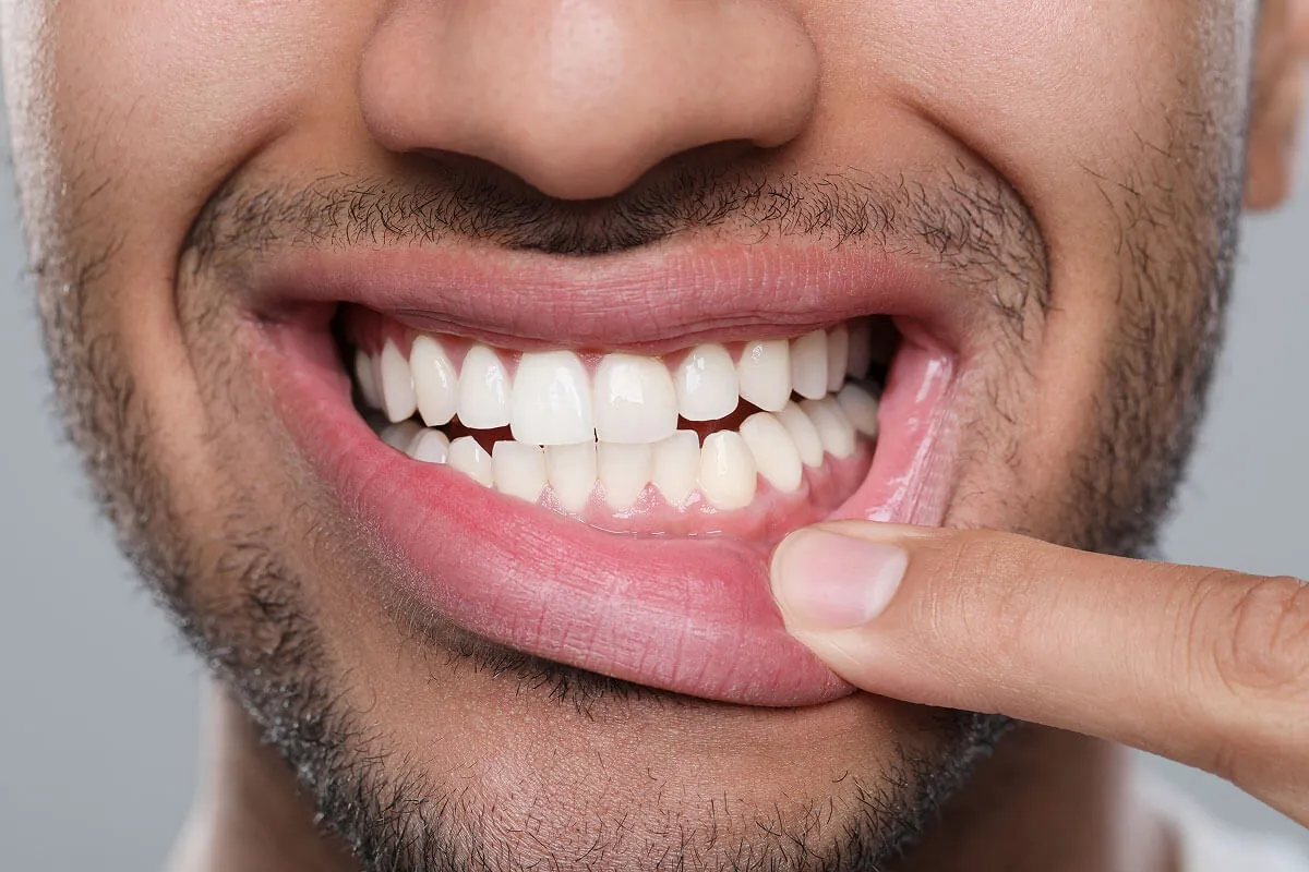 results of dental care from Beacon Hill Dental in Crown Point, IN